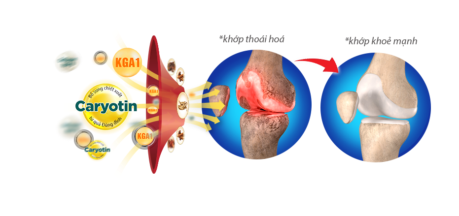 Cơ chế vượt trội của Khương Thảo Đan cho bệnh xương khớp.