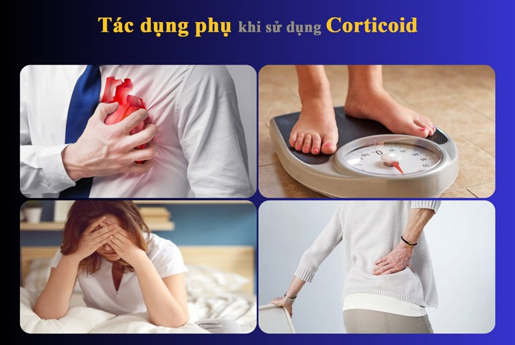 Một số tác dụng phụ không mong muốn của Corticoid