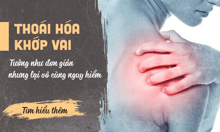 Thoái hóa khớp vai có triệu chứng gì? Cách điều trị hiệu quả