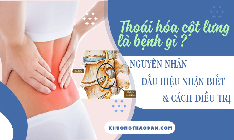 Thoái hoá đốt sống lưng là gì? Triệu chứng thoái hóa cột sống lưng