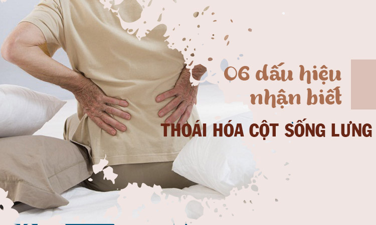 Dấu hiệu thoái hóa cột sống thắt lưng và cách điều trị