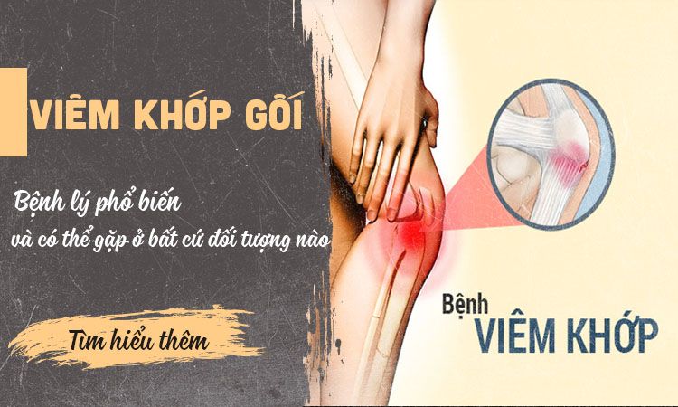 Viêm khớp gối là gì? Viêm khớp gối có nguy hiểm không