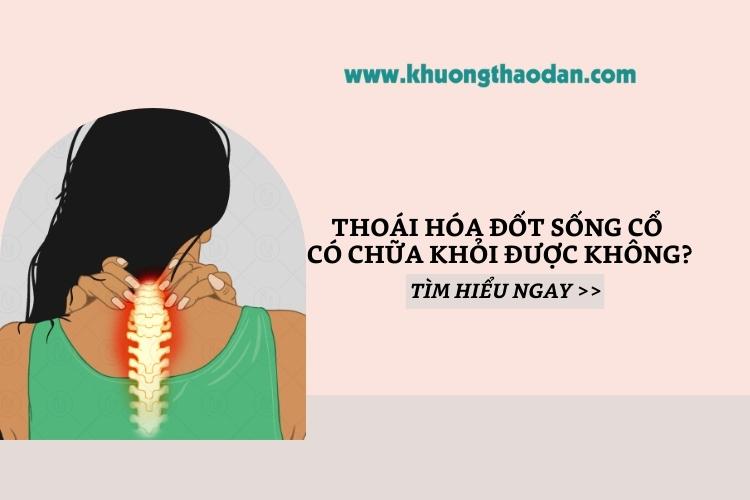 Thoái hóa đốt sống cổ có chữa khỏi được hoàn toàn không?