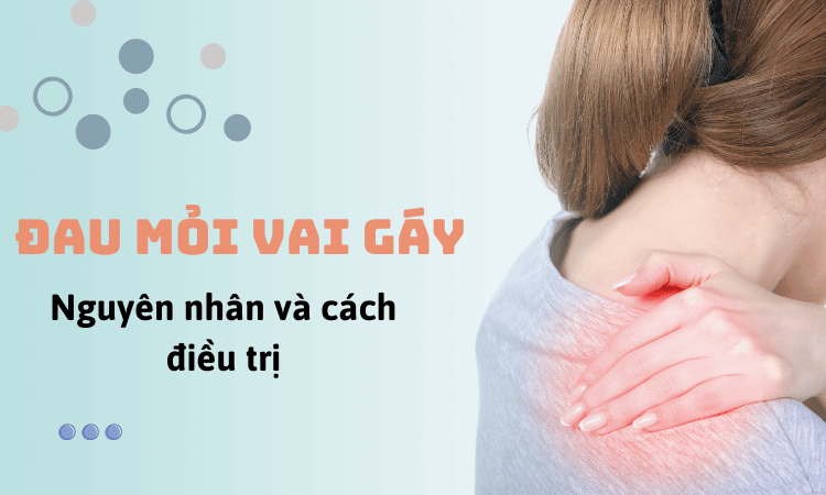 Hiểu hơn về chứng Đau mỏi vai gáy và cách điều trị phù hợp