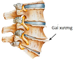 Gai xương