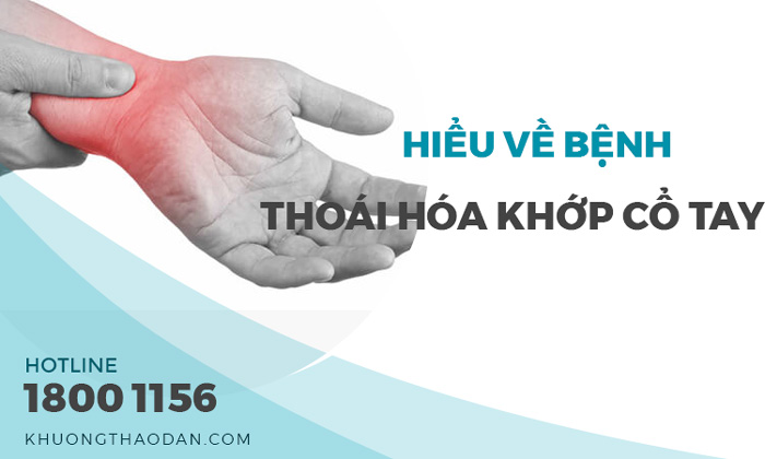 Thoái hóa khớp cổ tay là gì?