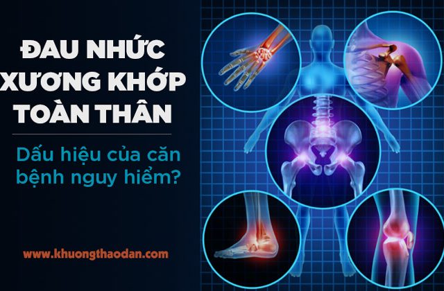 Đau nhức xương khớp toàn thân là bệnh gì