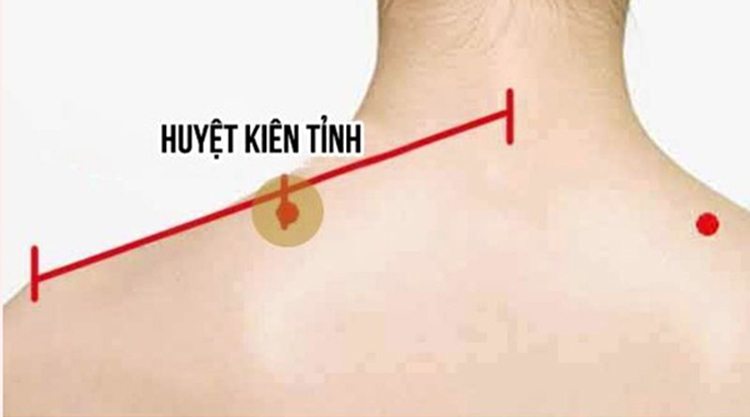 Vị trí huyệt kiên tỉnh