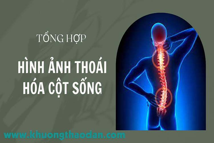 hinh-anh-thoai-hoa-cot-song